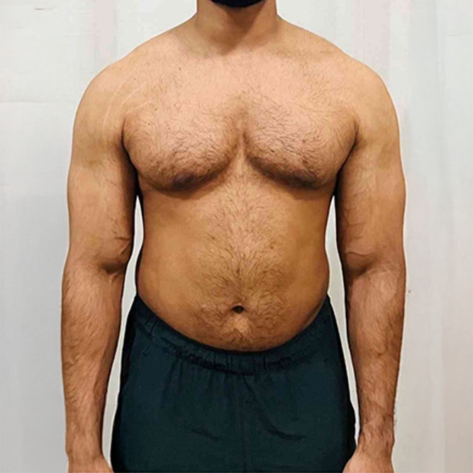 Before transformation