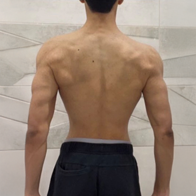 After transformation